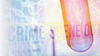 Forensic Anthropology